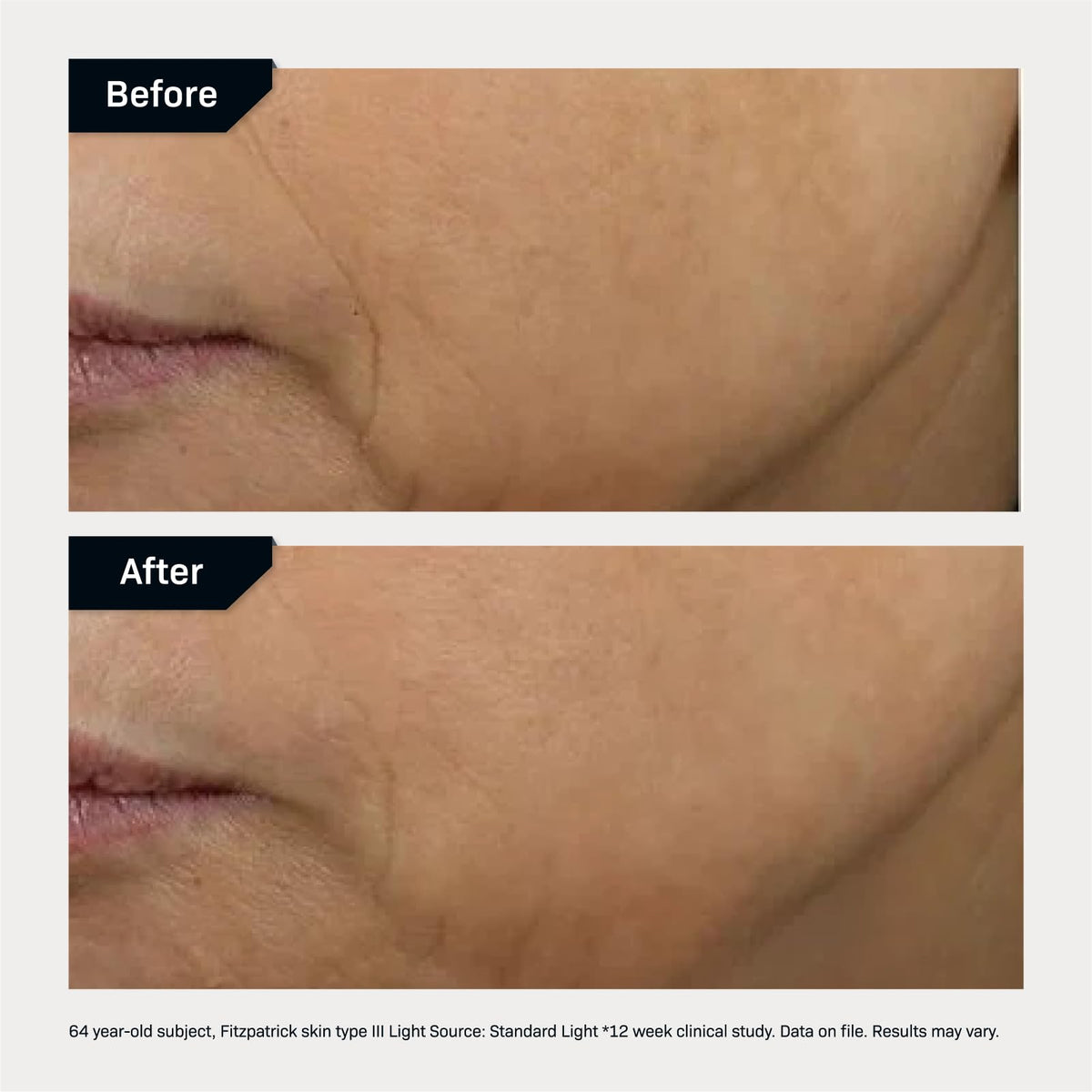 Revision Skincare D·E·J Face Cream packaging with label communicates premium anti-aging care.