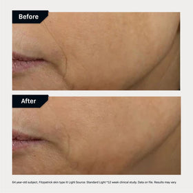 Revision Skincare D·E·J Face Cream packaging with label communicates premium anti-aging care.