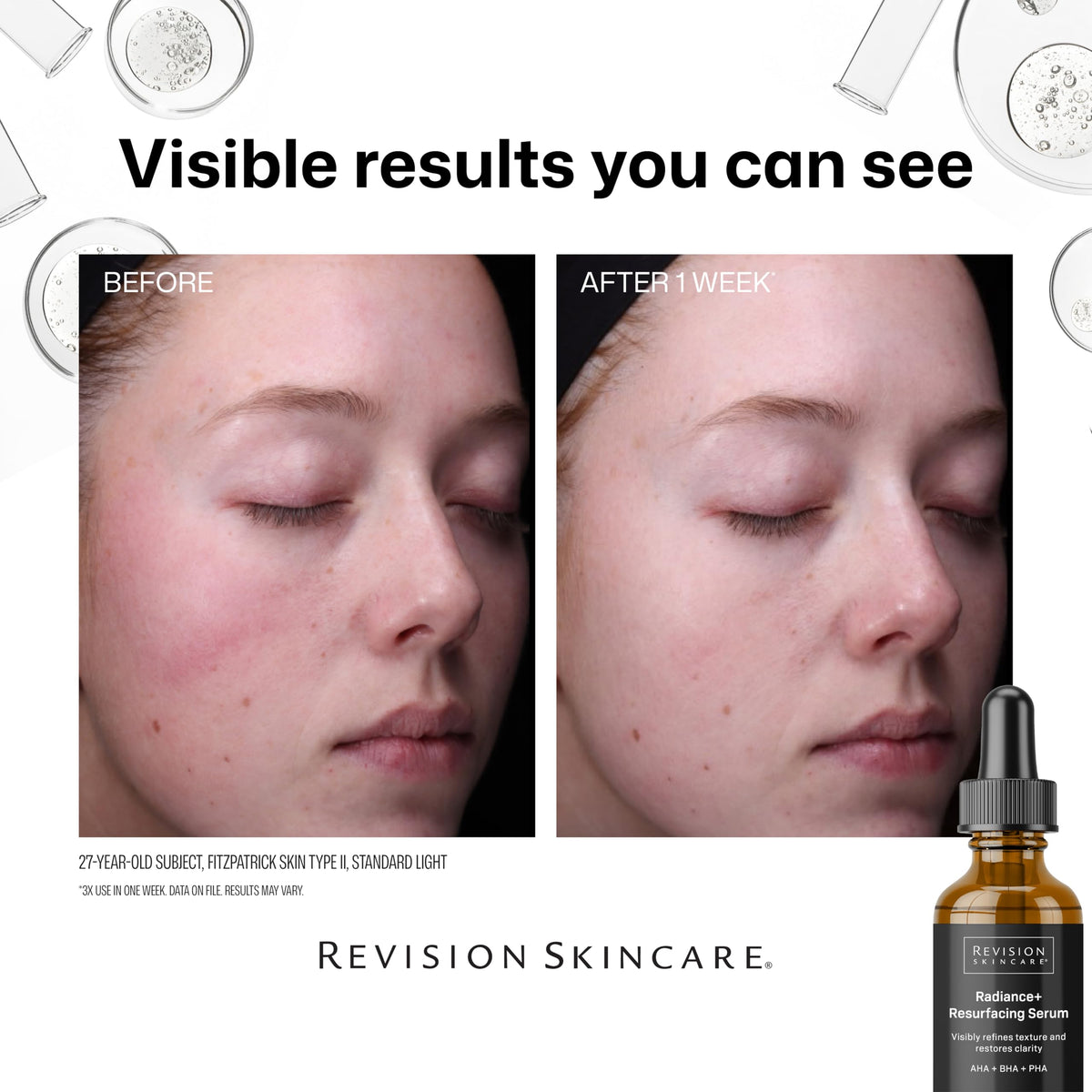 Revision Skincare Radiance+ close-up of pores indicating clearer complexion