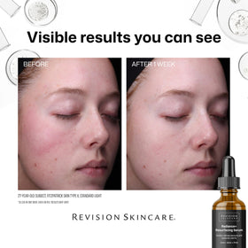 Revision Skincare Radiance+ close-up of pores indicating clearer complexion
