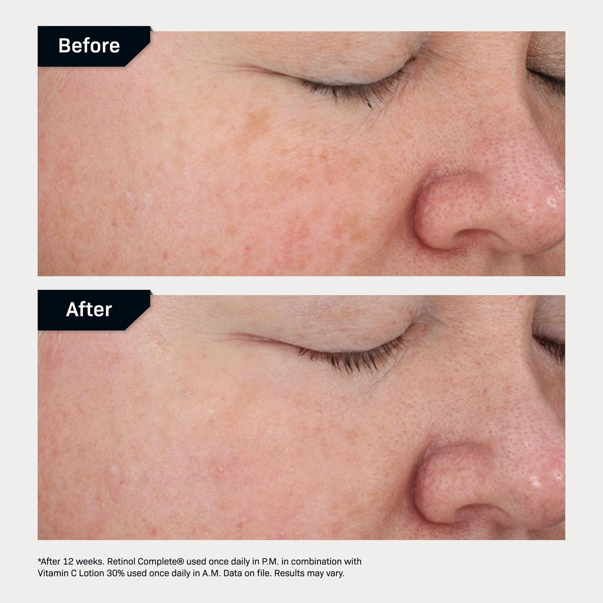 Revision Skincare Retinol Complete smoothing texture focus for even-toned, refined skin appearance.