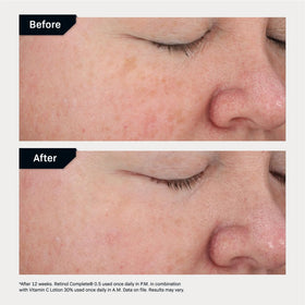 Revision Skincare Vitamin C Lotion 30% hydrating formula on skin.