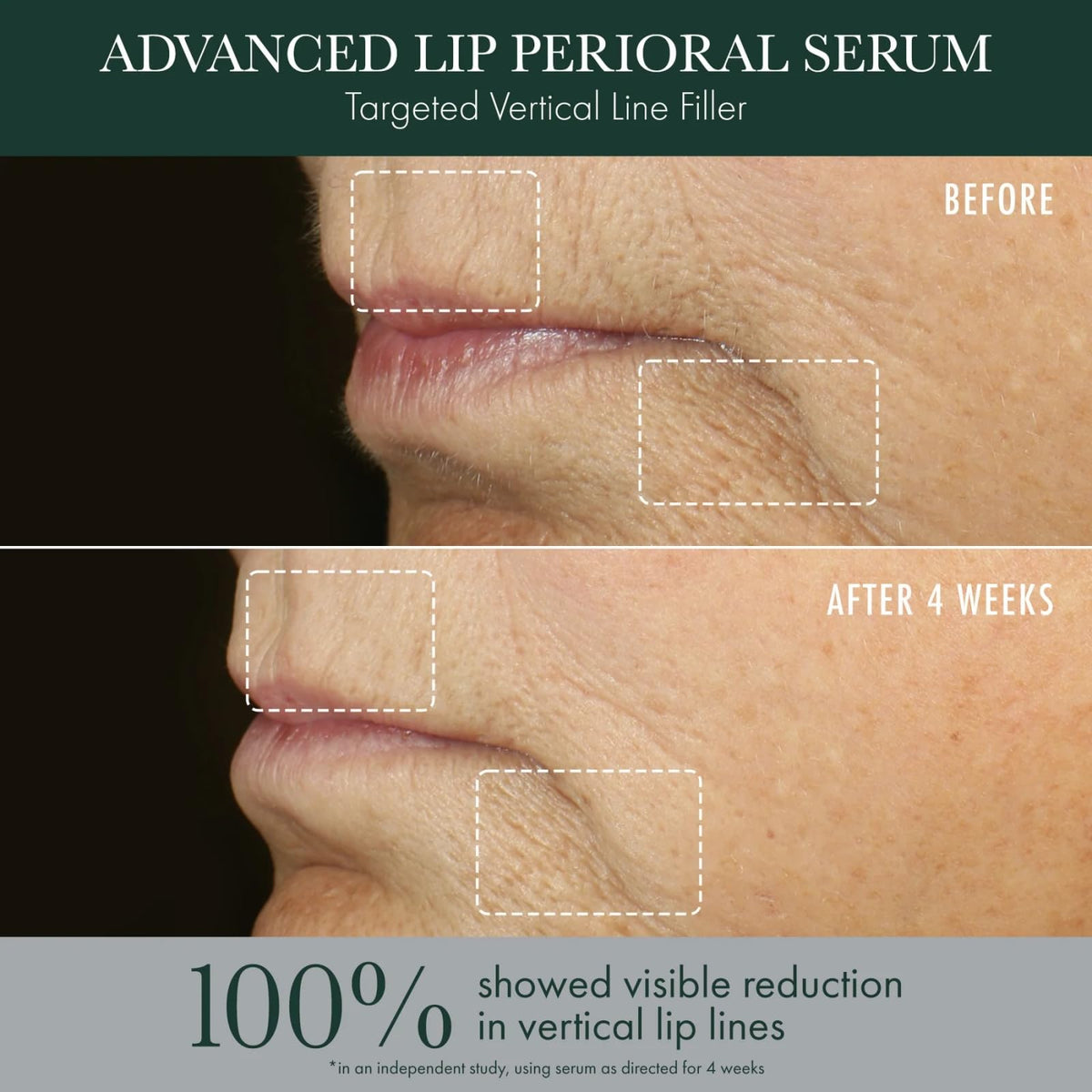 Ceramide Complex delivering moisture to perioral skin.
