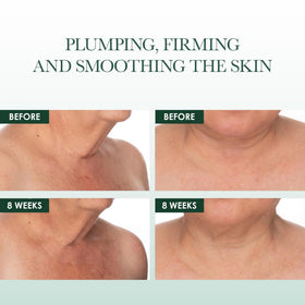 Application on neck highlights targeted care for décolletage with gentle lift possibility
