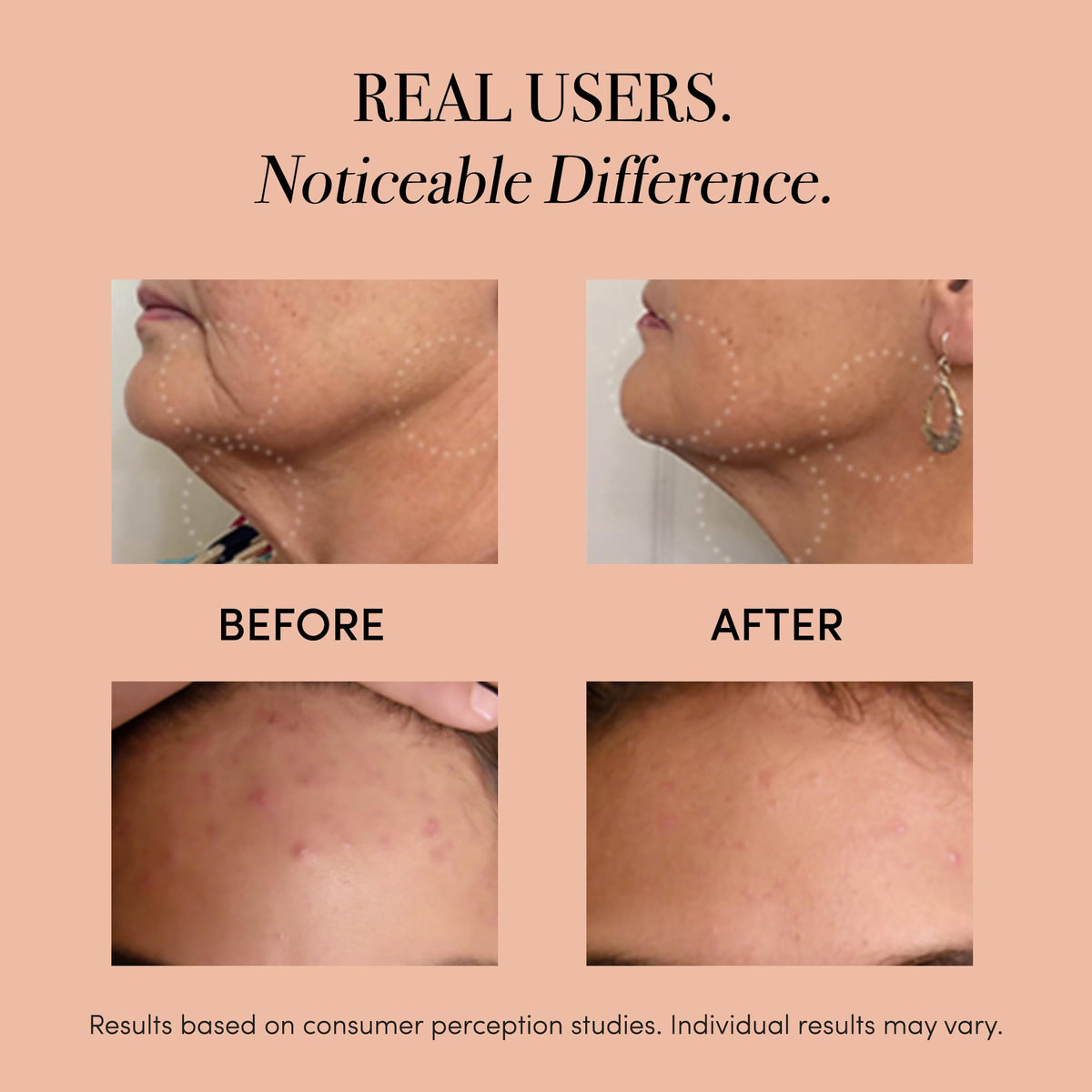 serum massage head from the Lux Soniqué for enhanced absorption.