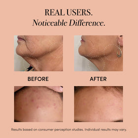 serum massage head from the Lux Soniqué for enhanced absorption.