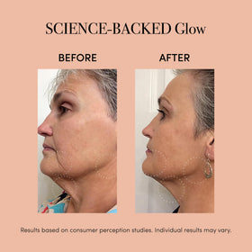 reVive Lux amber light enhances skin tone and clarity in daily use.