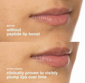 Rhode Lip Boost ingredients focus on peptide-rich formula and gentle hydration.