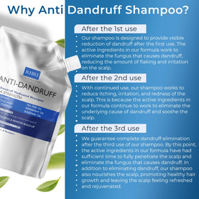 Rida Hair psoriasis dandruff relief shampoo on irritated scalp
