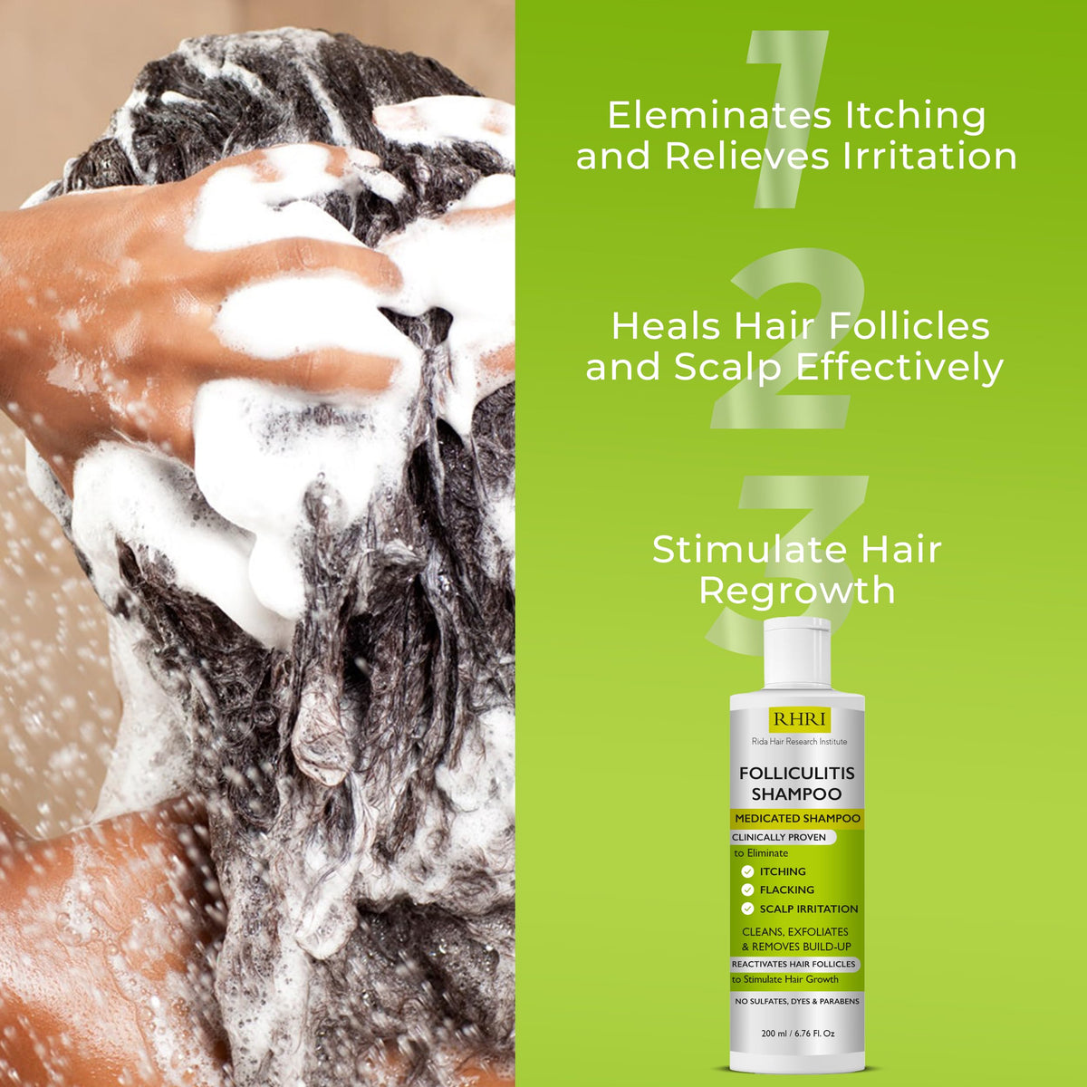 Rida Hair Research Institute anti fungal shampoo on display highlighting versatile scalp care