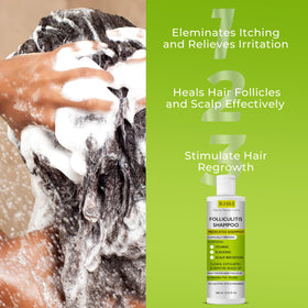Rida Hair Research Institute anti fungal shampoo on display highlighting versatile scalp care
