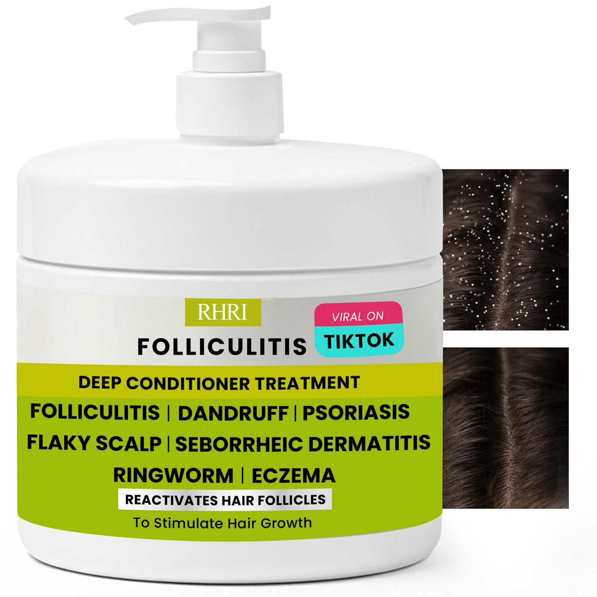 Rida Hair Research Institute Folliculitis Deep Conditioner bottle for soothing irritated scalp.