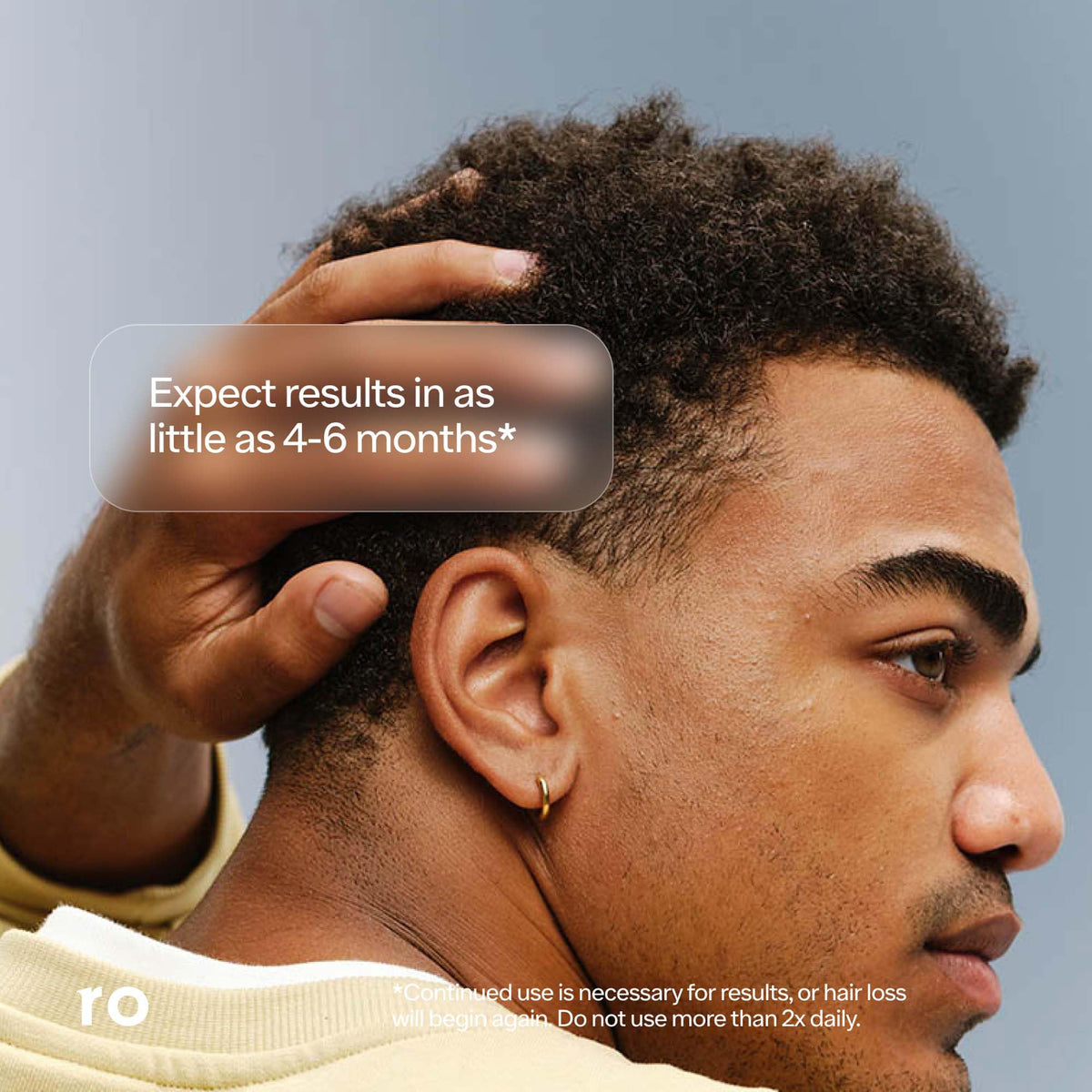 Ro Roman Minoxidil on scalp image highlights simple daily use