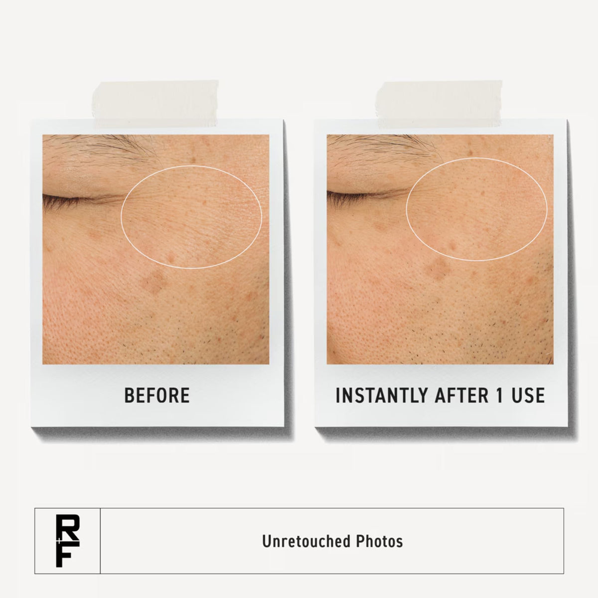 RODAN + FIELDS Hydra Mask Gel Cream jar closeup shows silky gel texture for all skin types