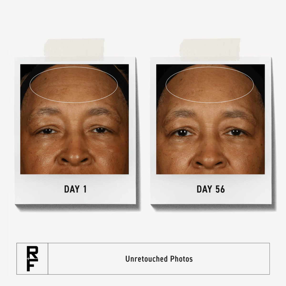 Rodan + Fields redefine toner tightens pores and prepares skin for absorption.