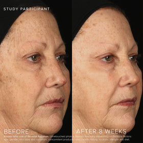 Rodan + Fields Reverse Face Care Setup demonstrates a streamlined skincare sequence.