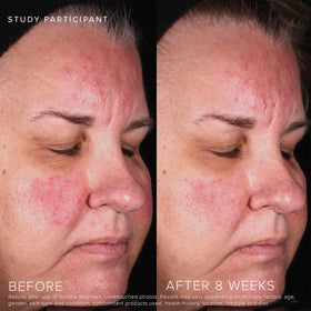 Rodan and Fields Soothe Calming Gel Cleanser after rinse, leaving a refreshed, non-tight sensation for sensitive skin.