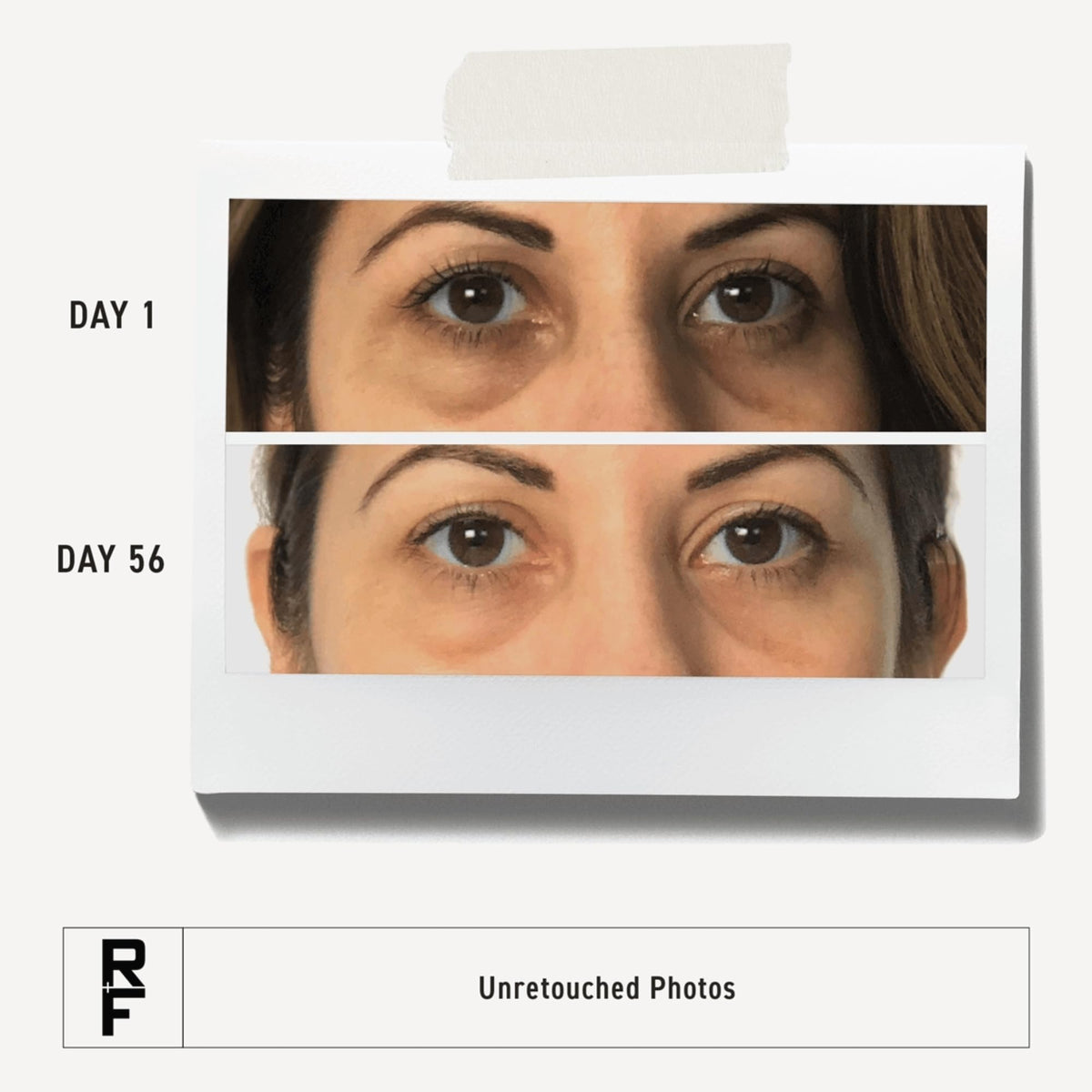 Rodan + Fields under-eye application close-up showing gentle hydrating care.