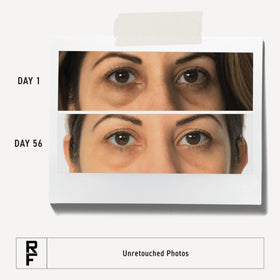 Rodan + Fields under-eye application close-up showing gentle hydrating care.