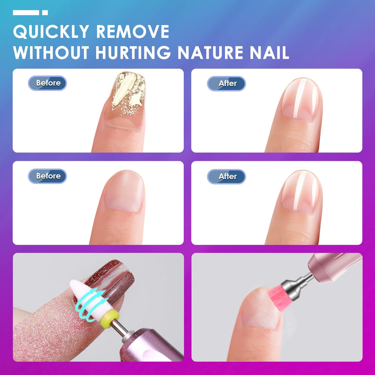 Rolokit dead skin remover bits for gentle prep before polish
