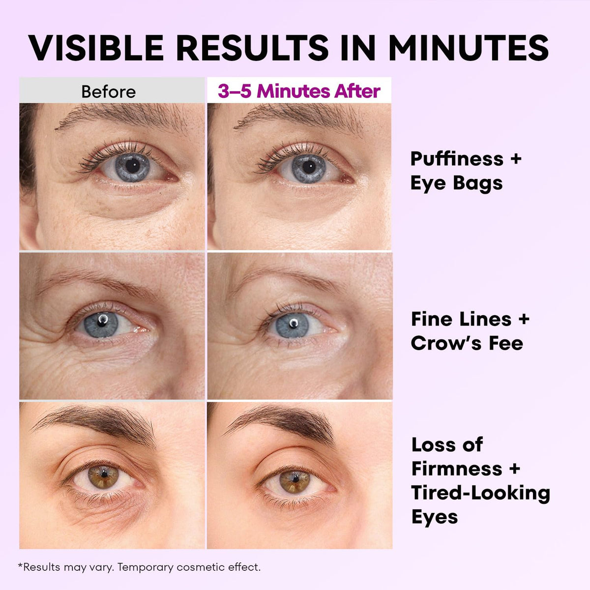 RONKIE Instant Eye Tightener applying under-eye for a smooth, even layer