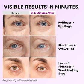 RONKIE Instant Eye Tightener applying under-eye for a smooth, even layer