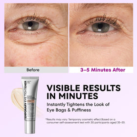 RONKIE Instant Eye Tightener cream texture on skin showing lightweight formula