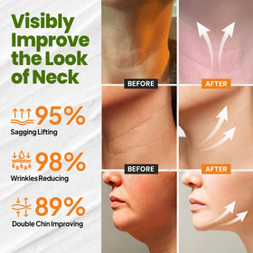 Neck area with retinol blend for a smoother look after Ronkie application.