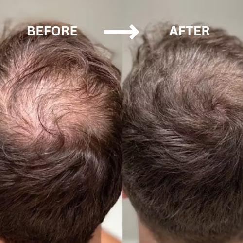 ROOT’D Hairline Powder provides 48-hour hold with natural finish.