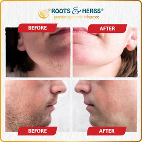 ROOTS AND HERBS smooth clay mask on upper lip for gentle pampering