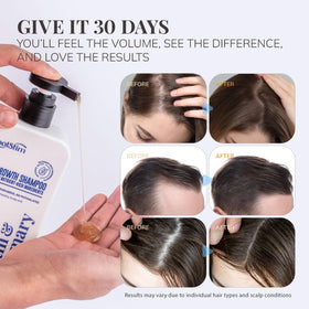 RootStim Biotin Rosemary Shampoo foam showing gentle, sulfate-free lather