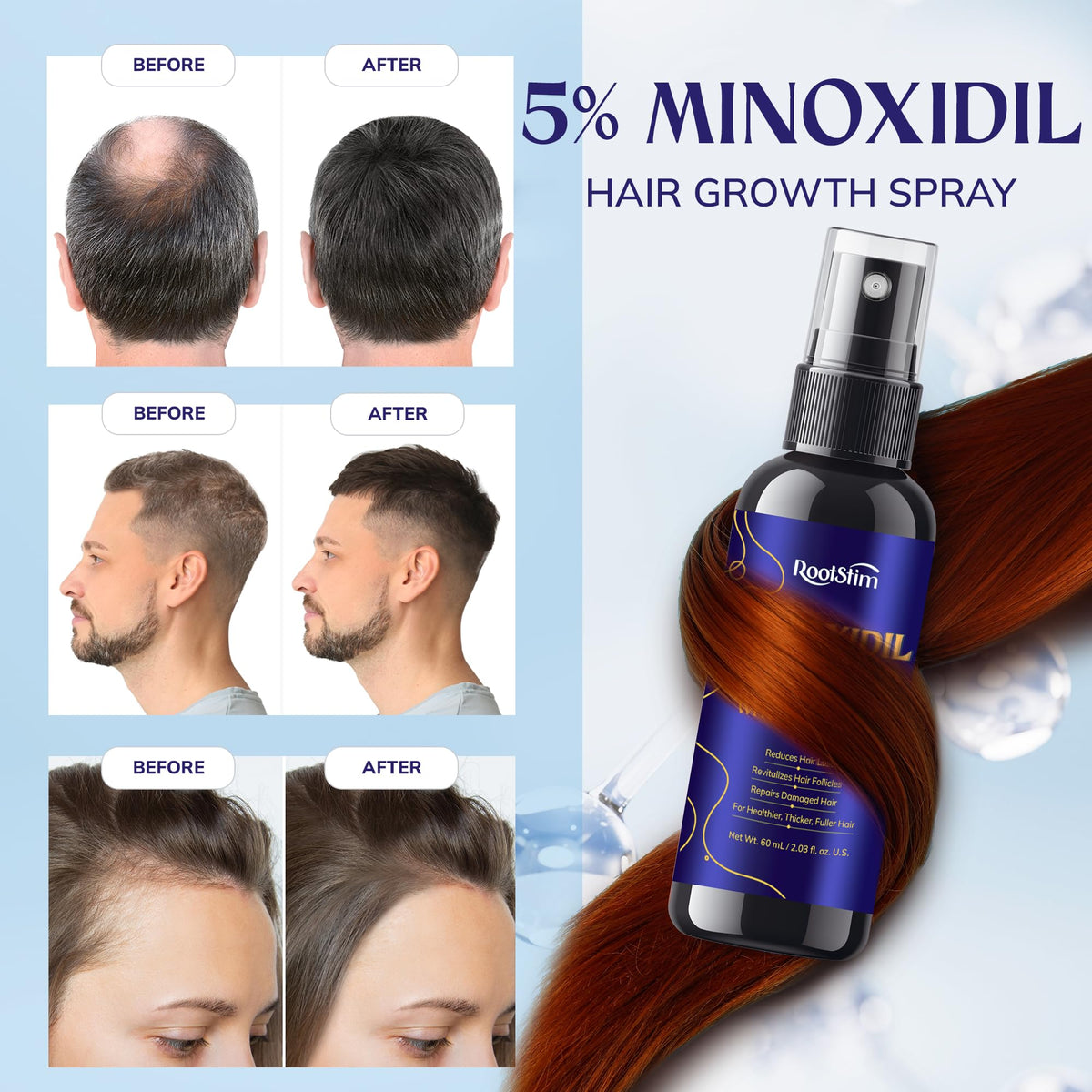 RootStim minoxidil bottle side view for easy dosing.