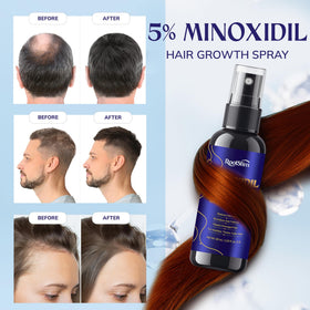 RootStim minoxidil bottle side view for easy dosing.