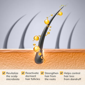 RootStim seborrheic-dermatitis-shampoo bottle-pump for easy washing.
