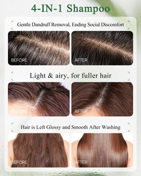 Ropink Mugwort Scalp Detox Shampoo ingredients highlight 1% salicylic acid.
