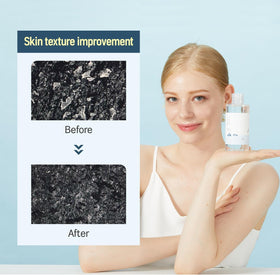 Lotion texture close-up reveals lightweight hydration from Round Lab 1025 Dokdo.