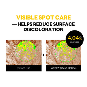 ROUND LAB Vita Niacinamide formula tranexamic acid concept close-up emphasizes even tone