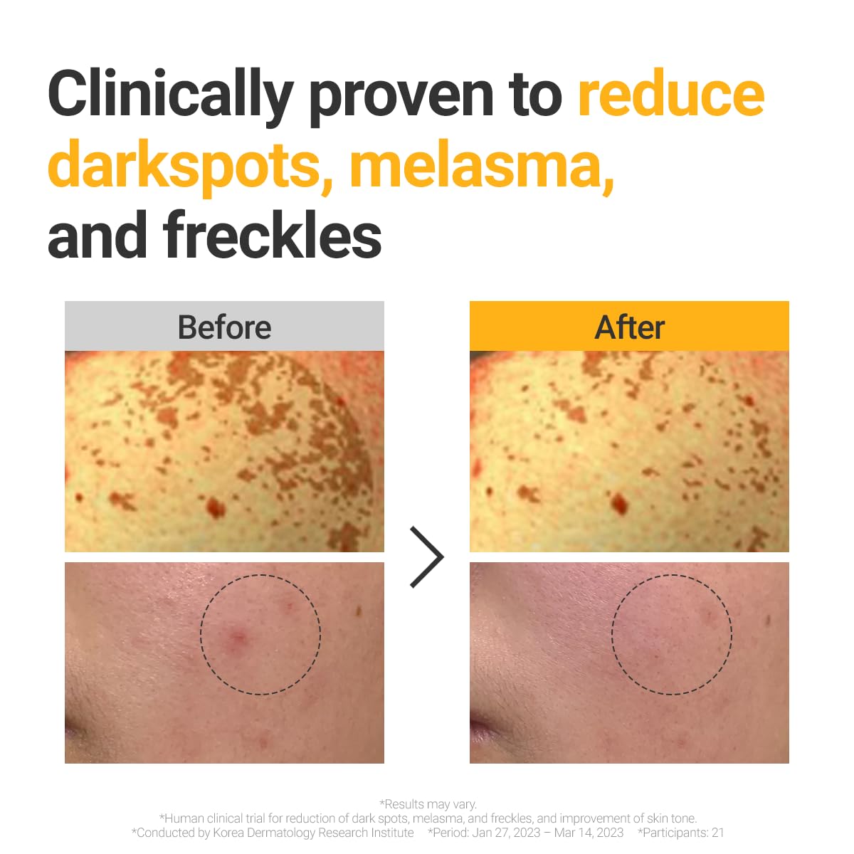 ROVECTIN Vita Dark Spot Serum close-up illustrating tone-evening potential.