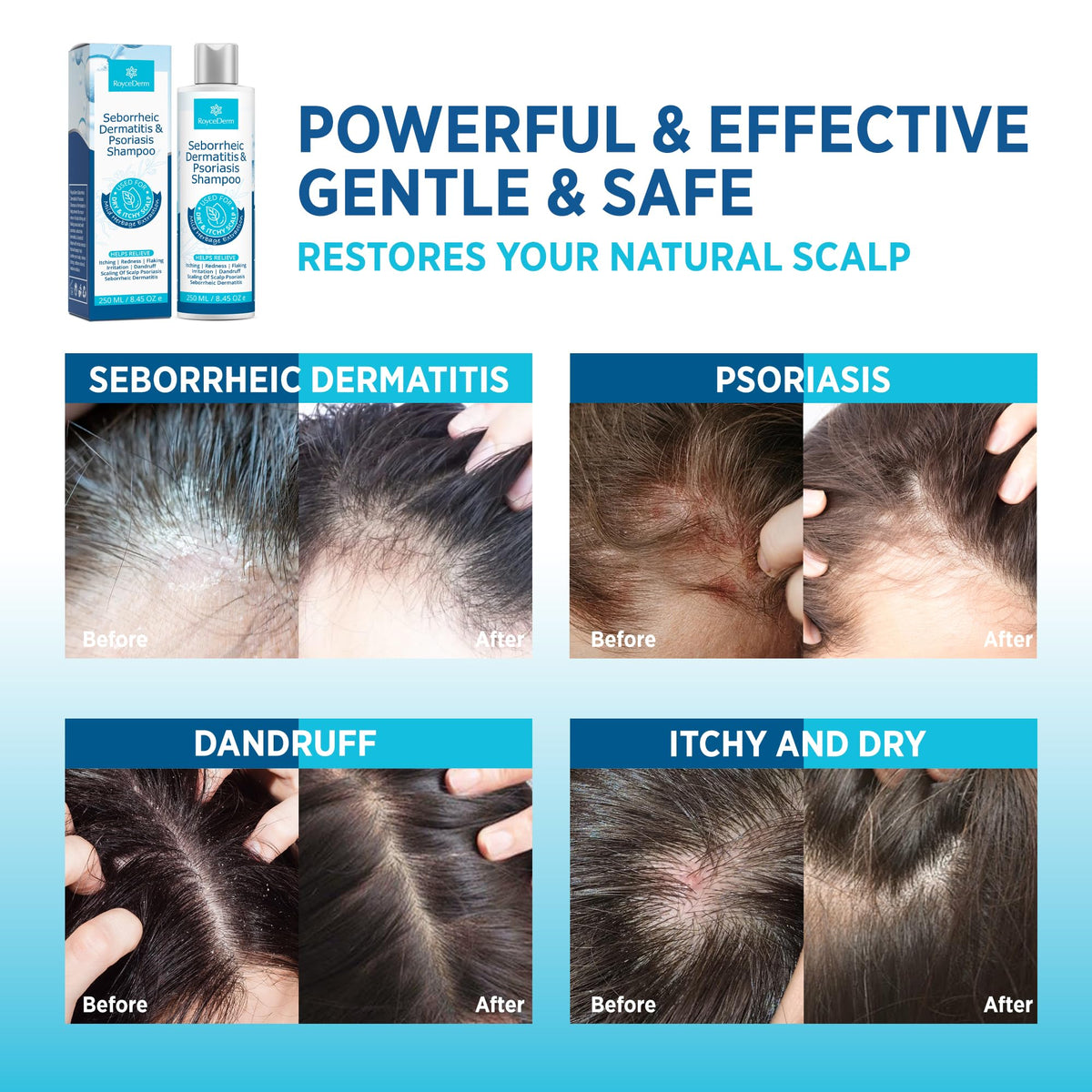 Roycederm 3-step system packaging communicates a complete daily routine.