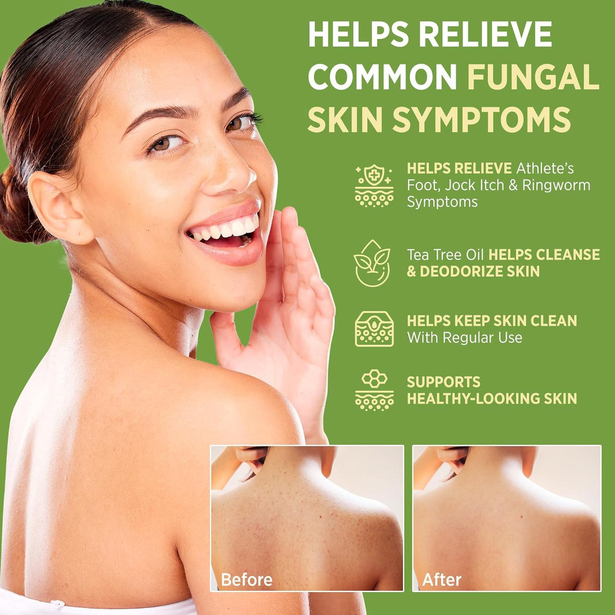 RoyceDerm label highlights 1% clotrimazole for antifungal care