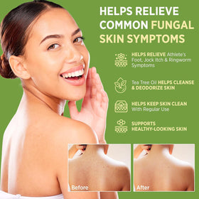 RoyceDerm label highlights 1% clotrimazole for antifungal care