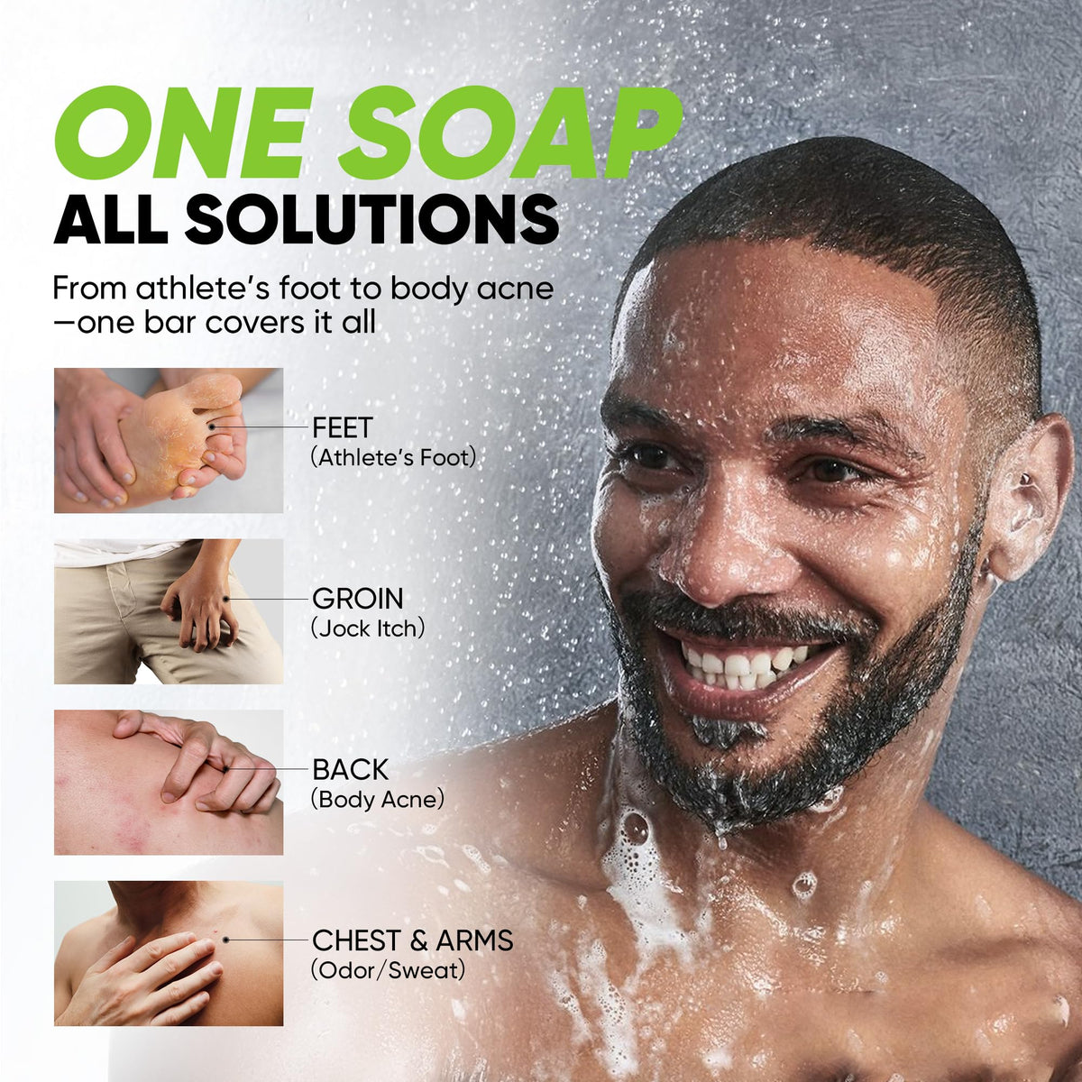 Roycederm antifungal soap bar activated charcoal image showcases deep-cleanse benefits.