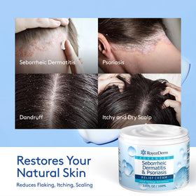 Roycederm scalp conditioner bottle hydrates and balances dry or oily roots.