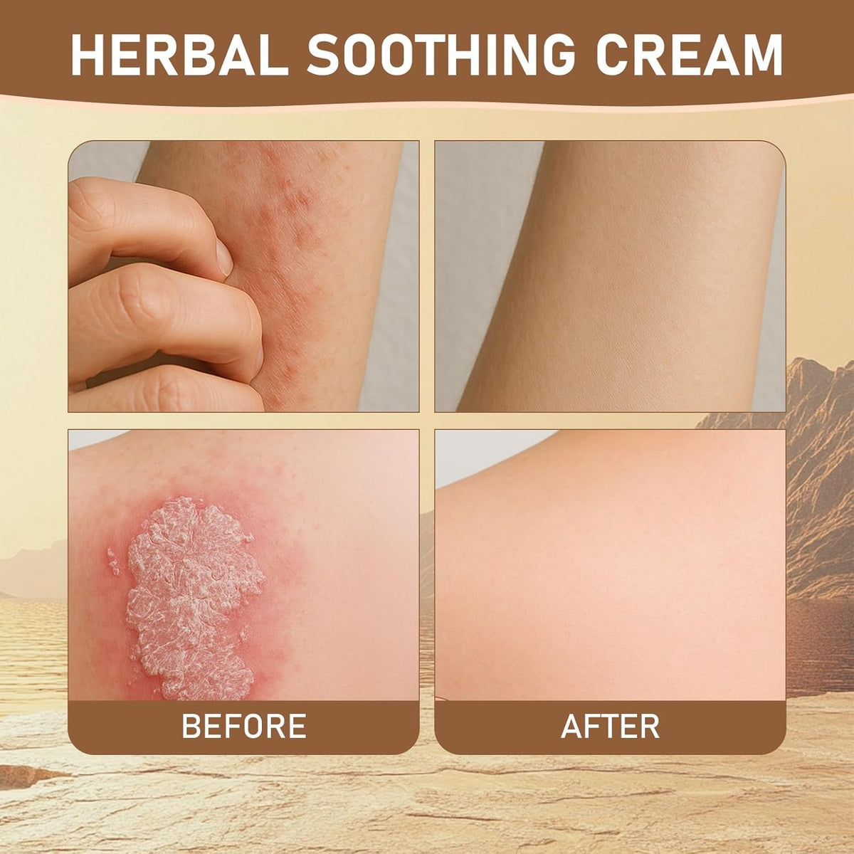Rulinal Herbal Soothing Cream hand application demonstrating quick relief.