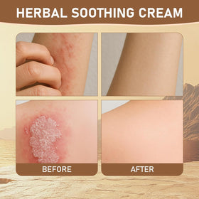 Rulinal Herbal Soothing Cream hand application demonstrating quick relief.