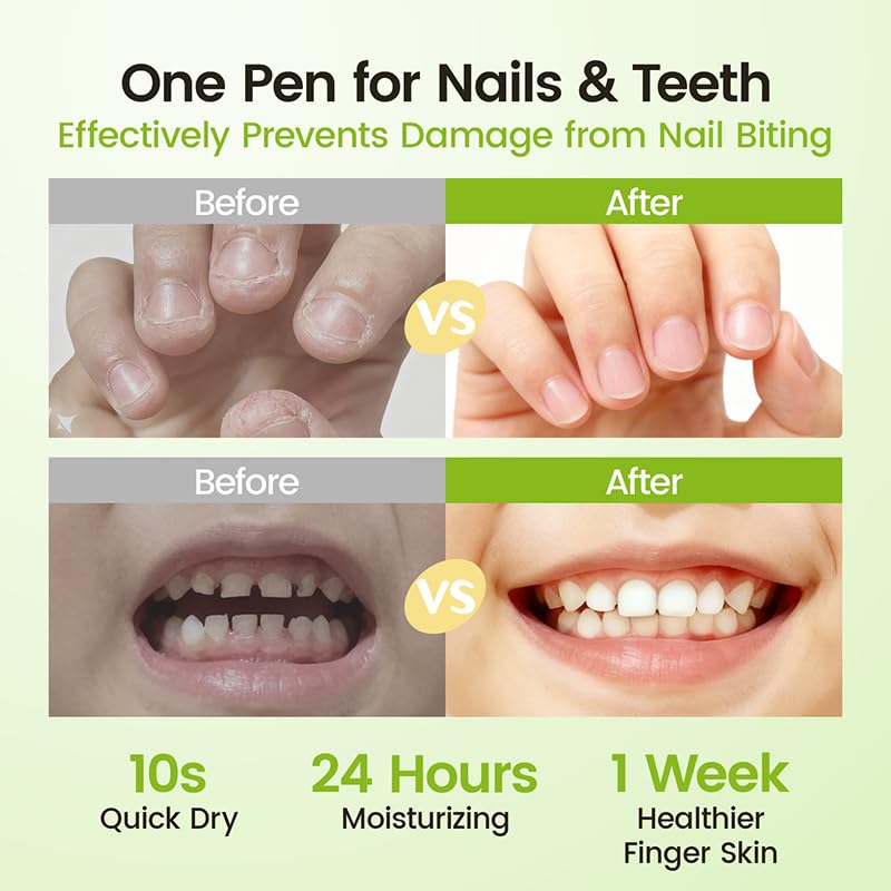 RUNBEN 5-in-1 plant oils nourish nails and skin
