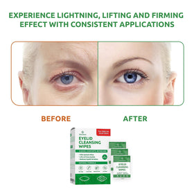 SaluVera Eyelid Wipes offer eye-area relief during long screen use.