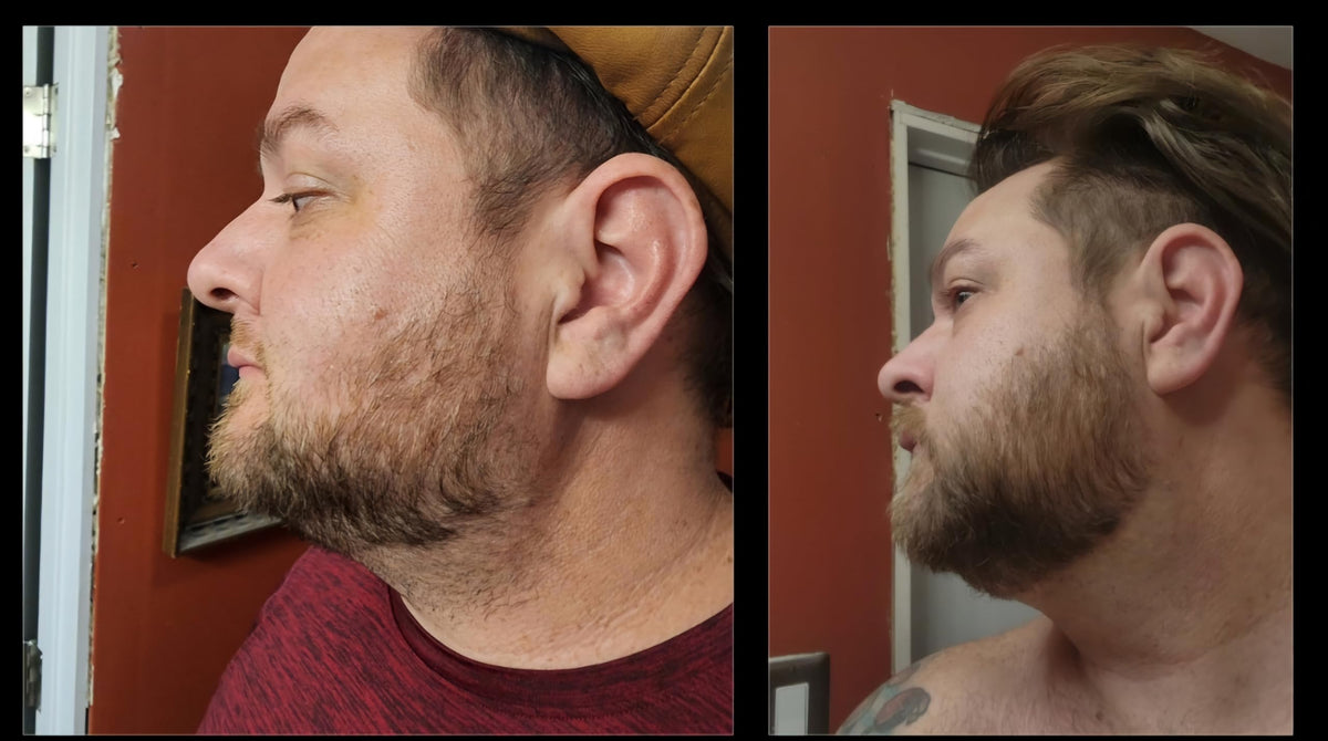Before and after style imagery showing visible scalp appearance.