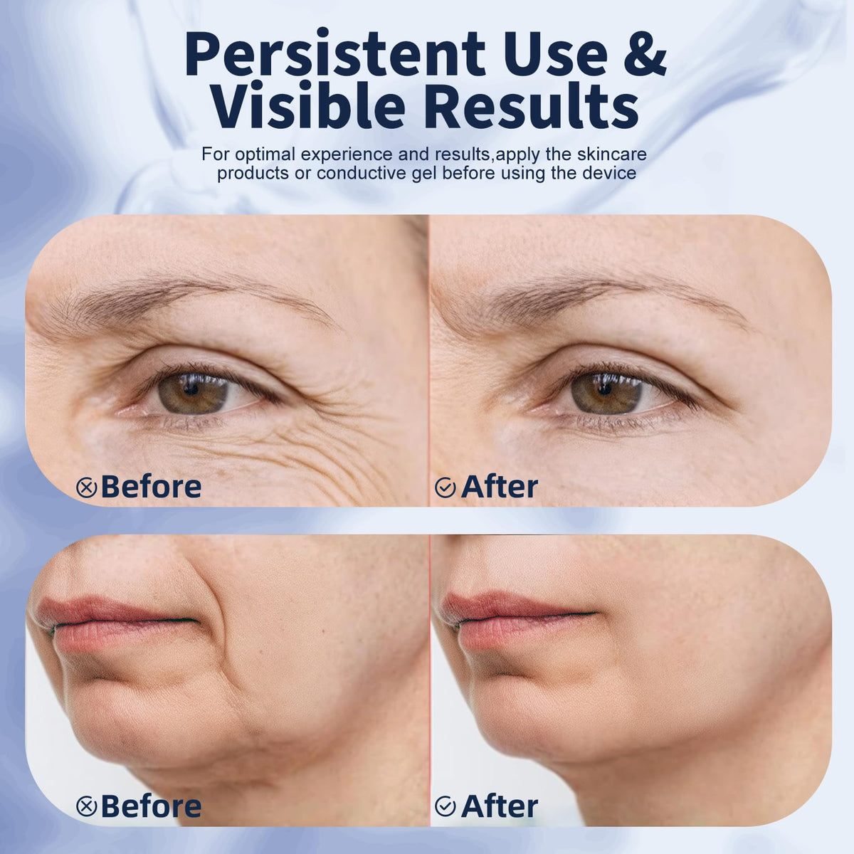 Satdally micro-current face massager for gentle facial contouring
