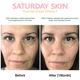 Caffeine in Saturday Skin Yuzu Eye Balm reduces under-eye puffiness